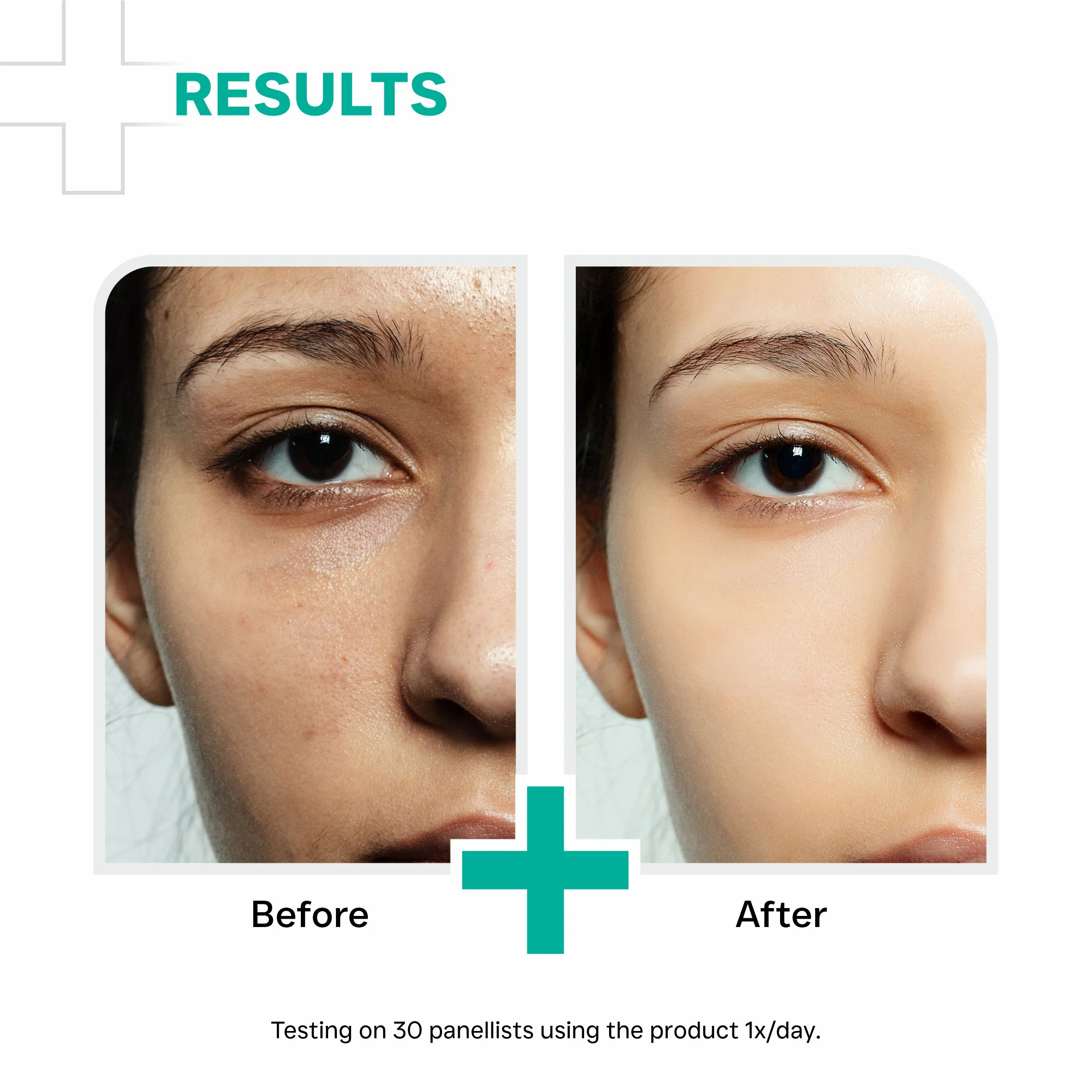 Niacinamide 10% + Zinc PCA 1% Serum 30ml - Image 5